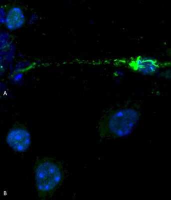 Immunocytochemistry/ Immunofluorescence: alpha-Synuclein [p Ser129] Antibody [NBP2-61121]